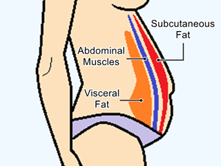 Diagram of a person -side view- showing the layers of abdominal and subcutaneous fat
