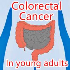 drawing gut colorectal cancer text