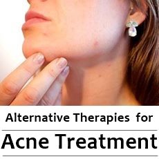 woman with pimples and acne on her face